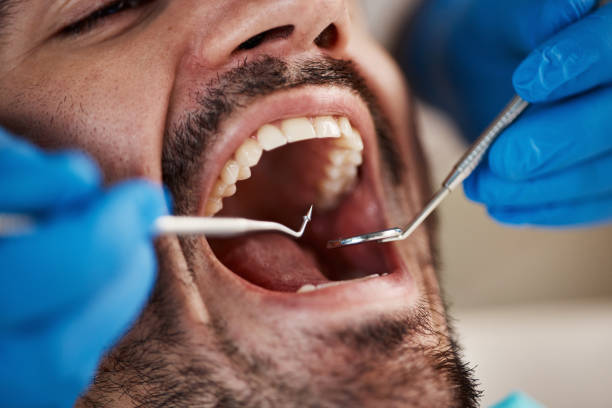 Best Dental Abscess Treatment in Dumbarton, VA